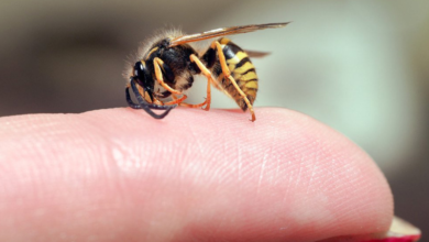 Doctors Warn: When a Bee Sting Becomes a Medical Emergency